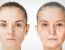 Benefits of Consulting a Plastic Surgeon in Oak Brook, IL