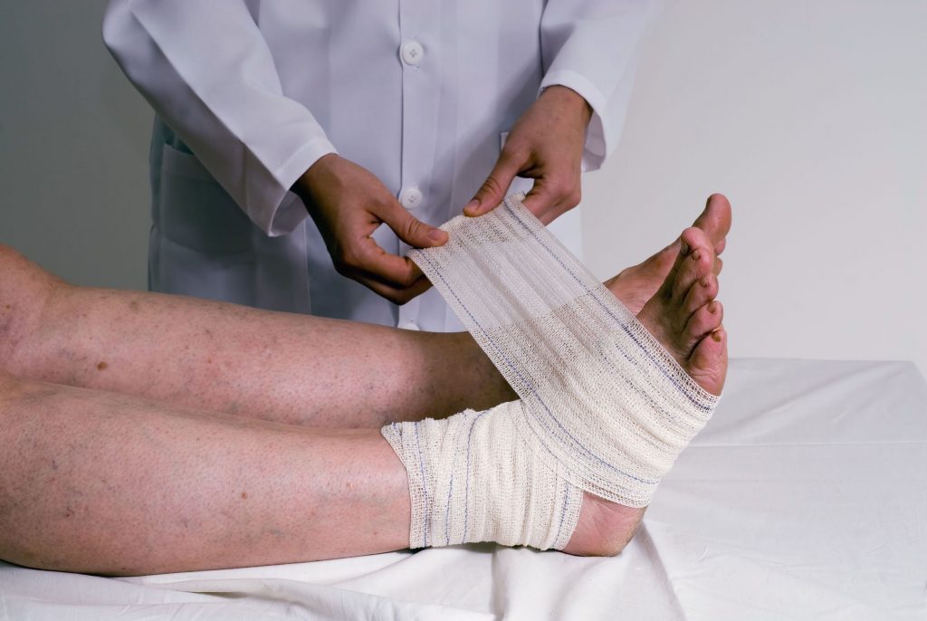 What Is The Best Way To Treat Heel Pain
