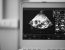 3 Things You Should Consider Before Buying Ultrasound Equipment