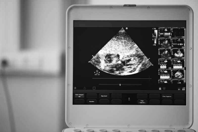 3 Things You Should Consider Before Buying Ultrasound Equipment