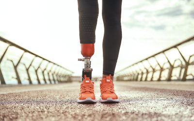 Find Personalized Solutions for Limb Loss at a Prosthetic Clinic in Meridian, ID Patients Trust